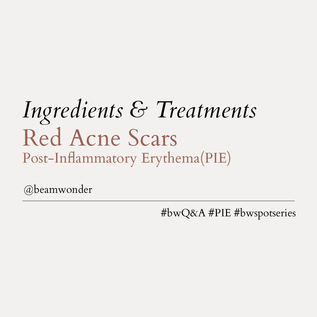 Ingredients & Treatments for Red Acne Scars (PIE)