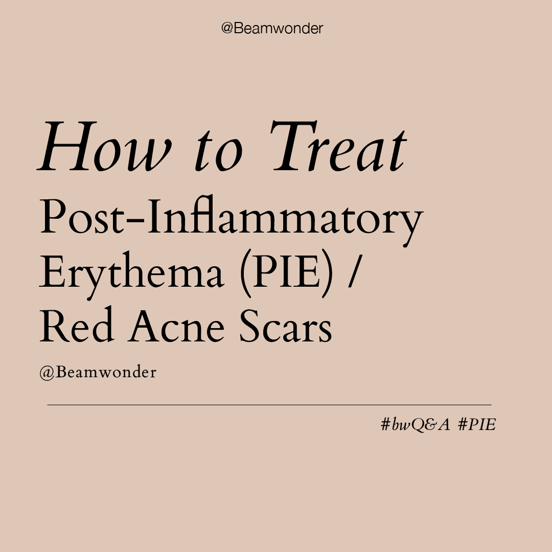 How to treat Red Acne Scars(PIE)